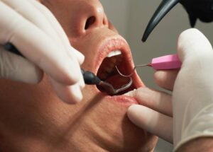 Perfect Dentist Oral Health Needs